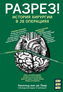 Разрез! История хирургии в 28 операциях - Арнольд Ван Де Лаар